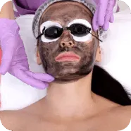 Carbon Laser Facial